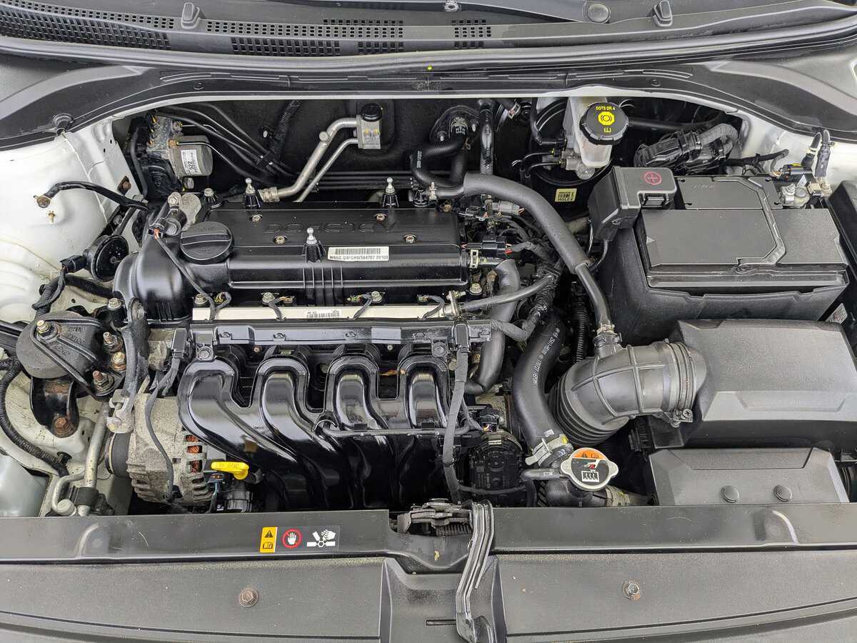 Hyundai Solaris с пробегом — 2017 год. Фото: #8